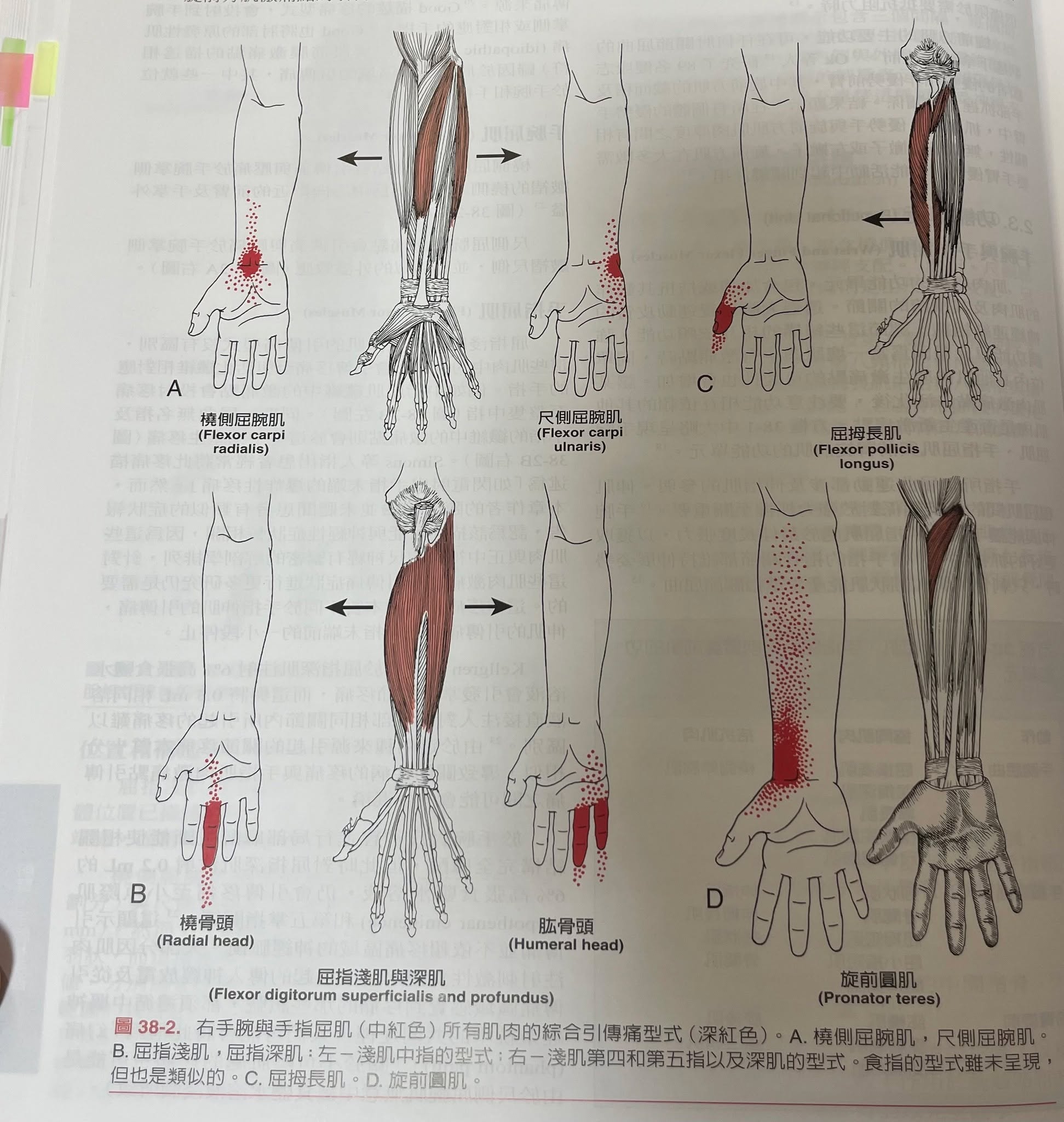 【第38章前臂的手腕與手指屈肌群】・原貼文圖片 1