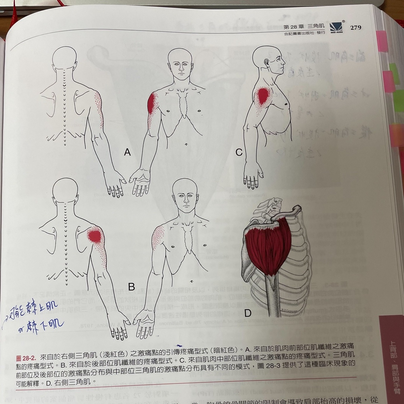 【第28章三角肌】肩部的隱蔽干擾者・原貼文圖片 1