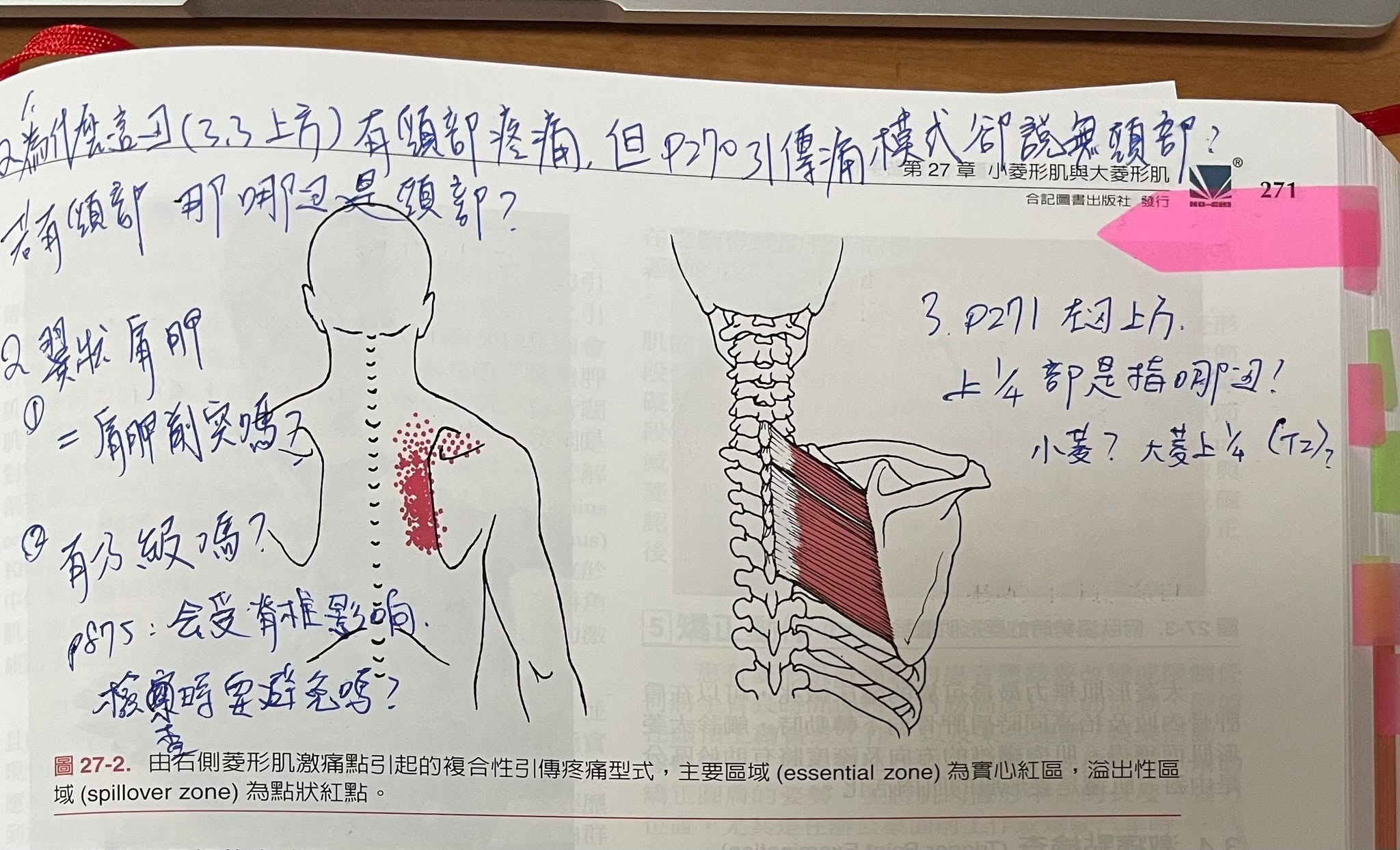 【第27章菱形肌】膏肓痛的解剖真相・原貼文圖片 1