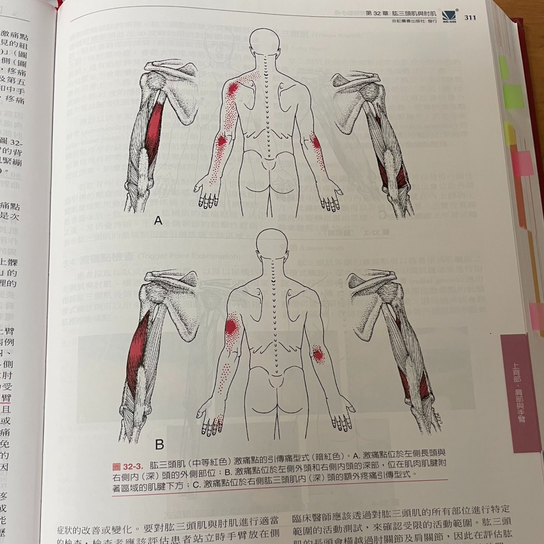 【第32章-肱三頭肌與肘肌】網球肘與高爾夫球肘的臨床盲點:你找對「大魔王」了嗎?・原貼文圖片 1