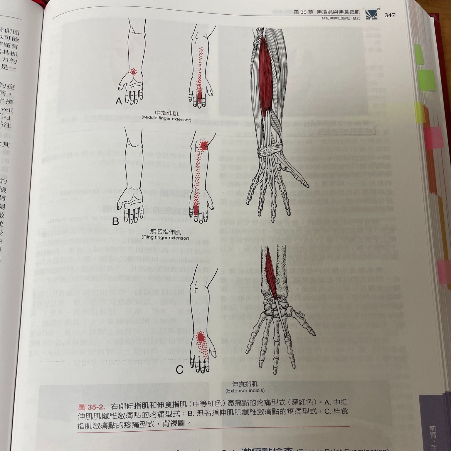 【第35章】伸指肌與伸食指肌・原貼文圖片 1